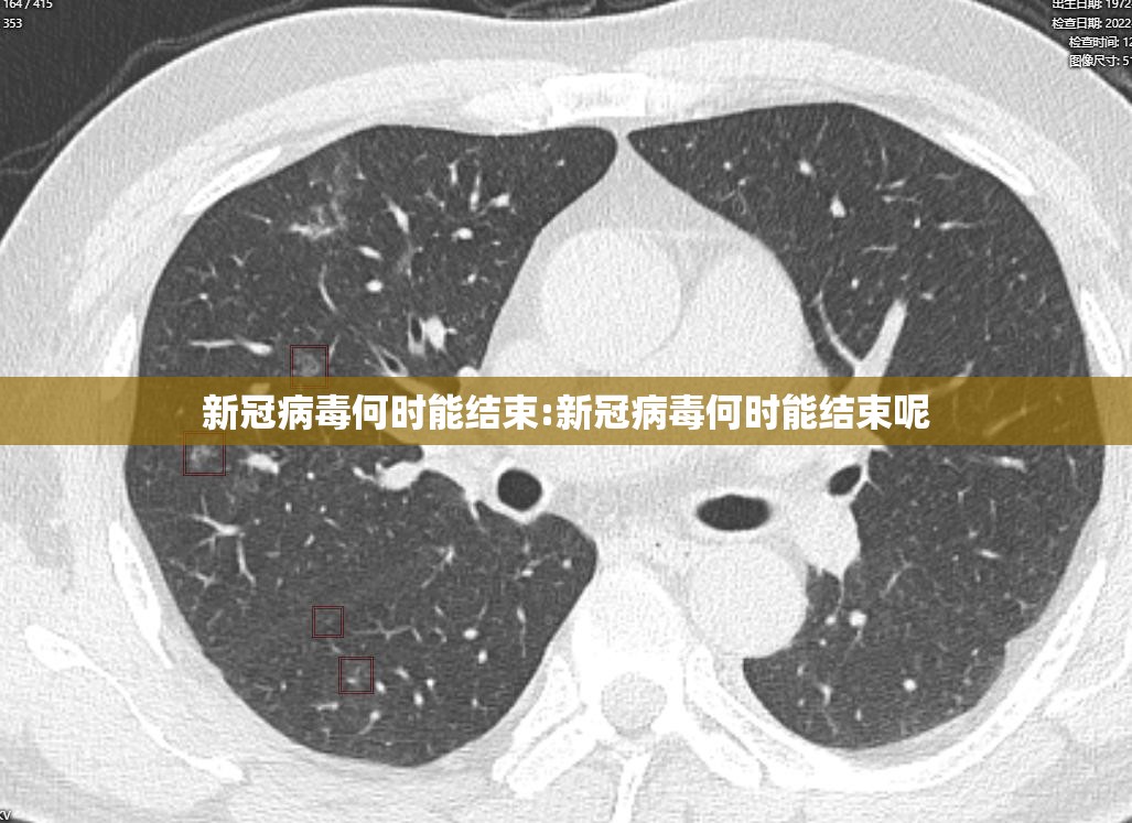 新冠病毒何时能结束:新冠病毒何时能结束呢