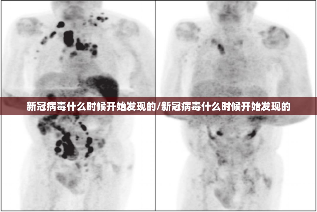 新冠病毒什么时候开始发现的/新冠病毒什么时候开始发现的