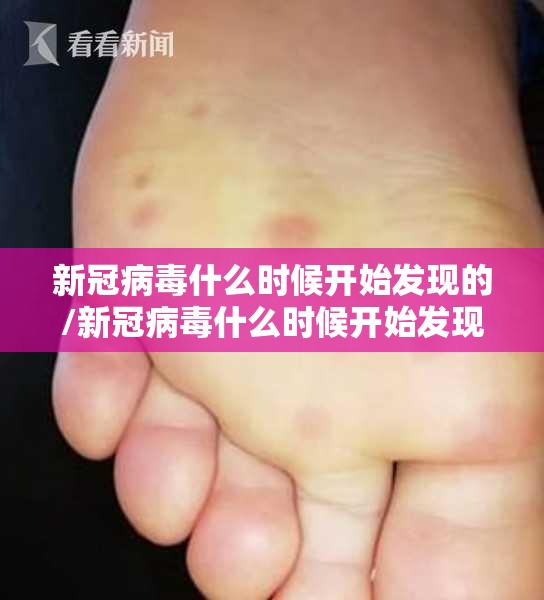 新冠病毒什么时候开始发现的/新冠病毒什么时候开始发现的
