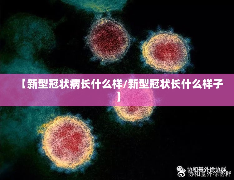 【新型冠状病长什么样/新型冠状长什么样子】
