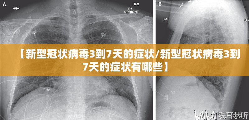 【新型冠状病毒3到7天的症状/新型冠状病毒3到7天的症状有哪些】