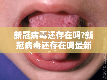 新冠病毒还存在吗?新冠病毒还存在吗最新消息