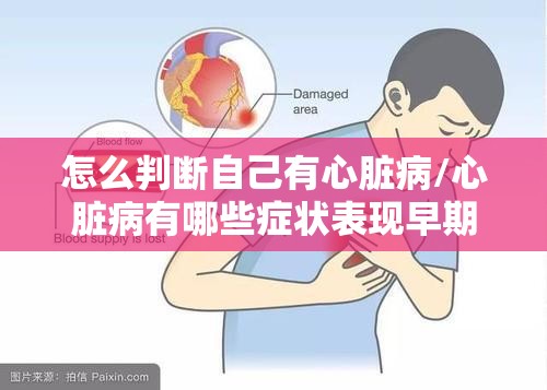 怎么判断自己有心脏病/心脏病有哪些症状表现早期