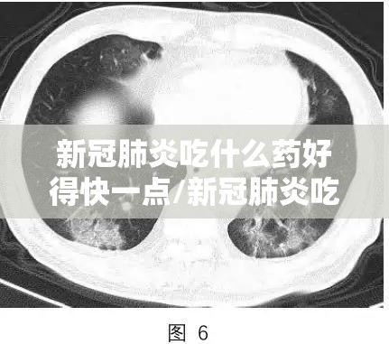 新冠肺炎吃什么药好得快一点/新冠肺炎吃什么药最有效