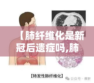 【肺纤维化是新冠后遗症吗,肺纤维化是新冠后遗症吗能治好吗】