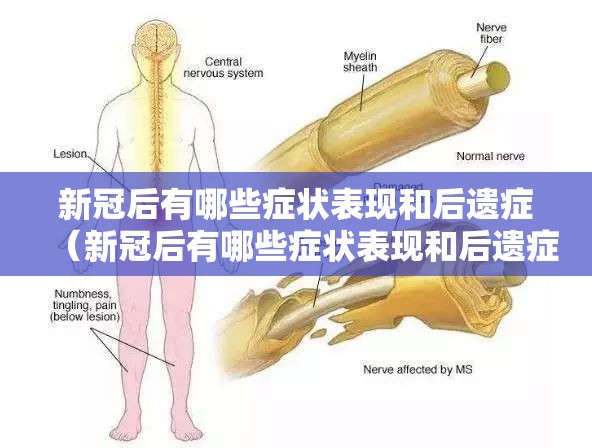 新冠后有哪些症状表现和后遗症（新冠后有哪些症状表现和后遗症呢）