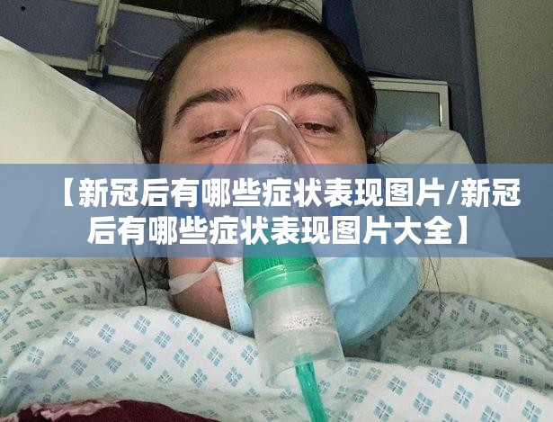 【新冠后有哪些症状表现图片/新冠后有哪些症状表现图片大全】