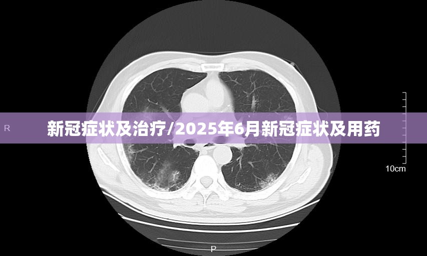 新冠症状及治疗/2025年6月新冠症状及用药